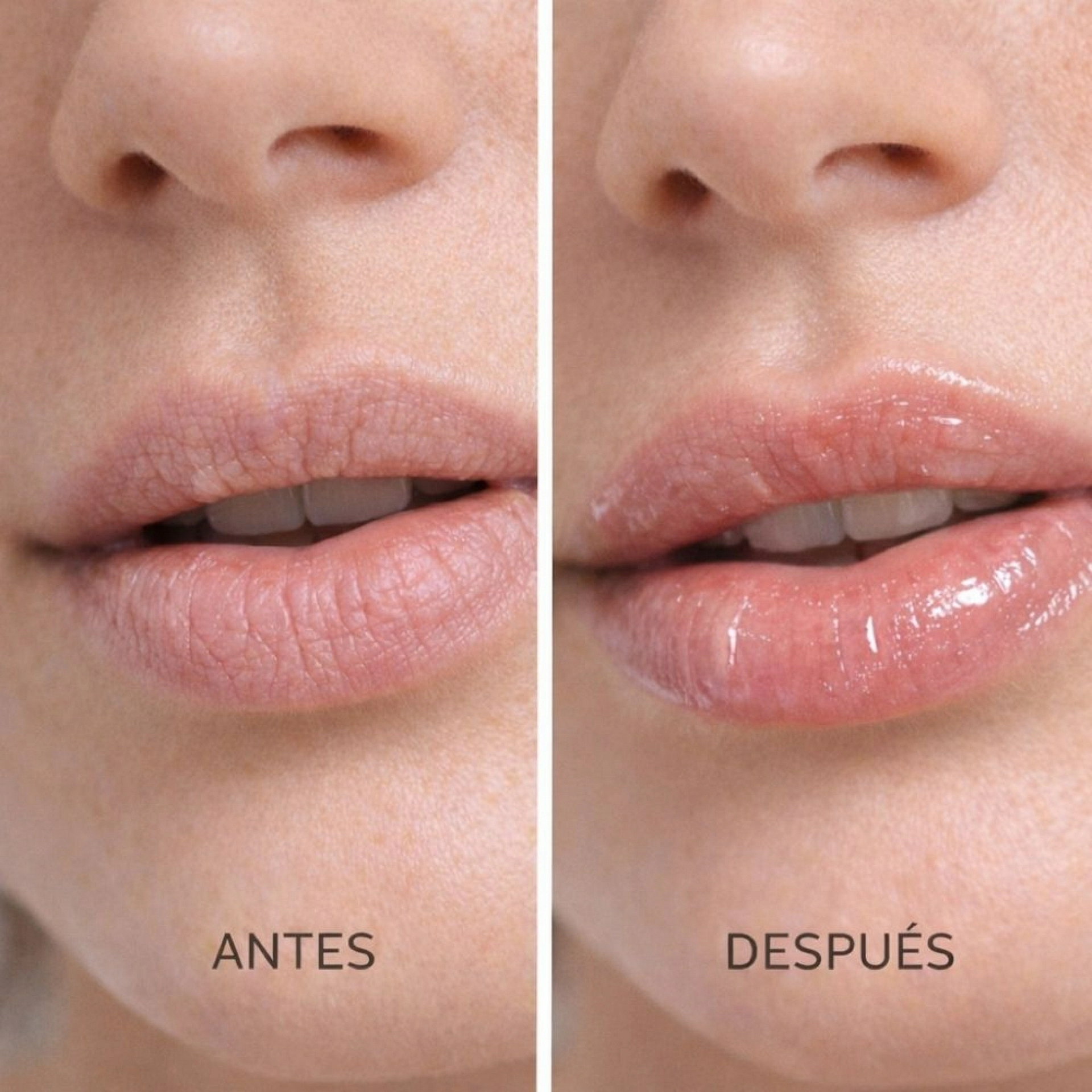 Bálsamo Labial Rosa Mosqueta | Bálsamo Reparador 5 gr  - Arôms Natur ®