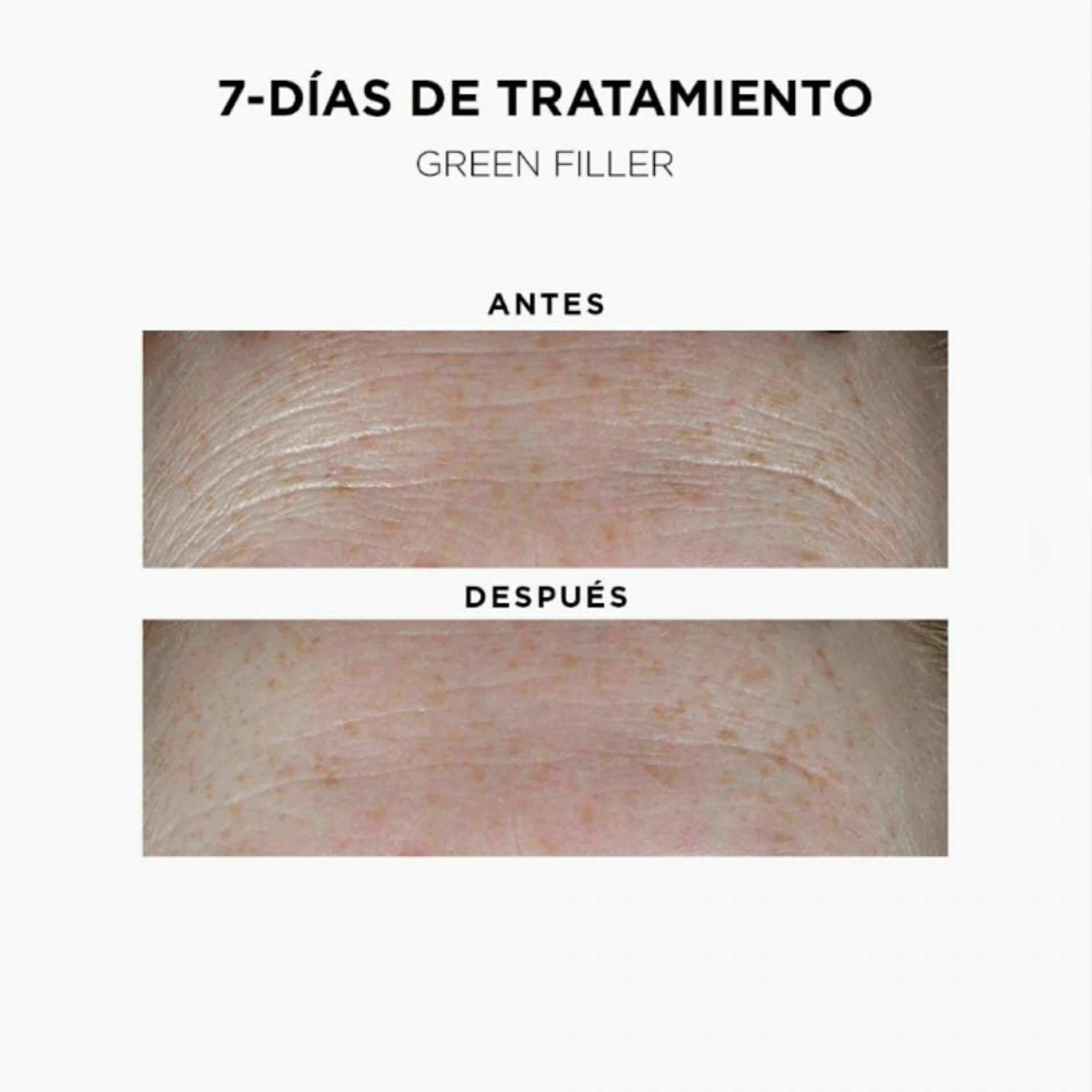 Soin Cure 7 Jours | Ampollas Rellenadoras de Arrugas 7 x 1,2 ml - Green Filler - Ella Baché ®
