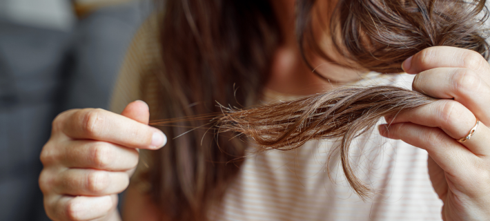 Caída del pelo