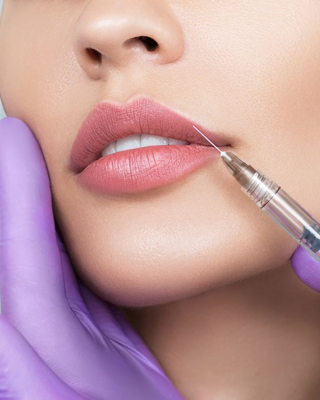 Mujer pinch&aacute;ndose los labios con una aguja