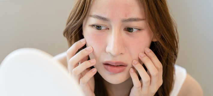 Mujer con enrojecimiento facial observando irritación en la piel frente al espejo