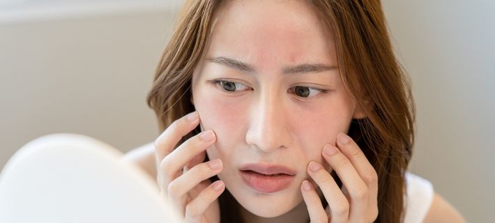 Mujer con enrojecimiento facial observando irritación en la piel frente al espejo